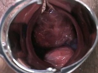 Signora incinta giapponese viene esaminato e succhia lollicock del wharf